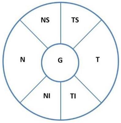 Characteristics of optic disc hemorrhage and optic nerve changes following acute primary angle closure